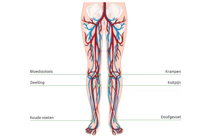 Schematische weergave van de bloedcirculatie in de benen. Een slechte bloedsomloop zorgt voor vermoeide benen.