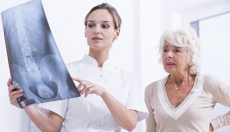 Een dokter laat een MRI-scan zien aan een vrouw met klachten van artrose in de rug.