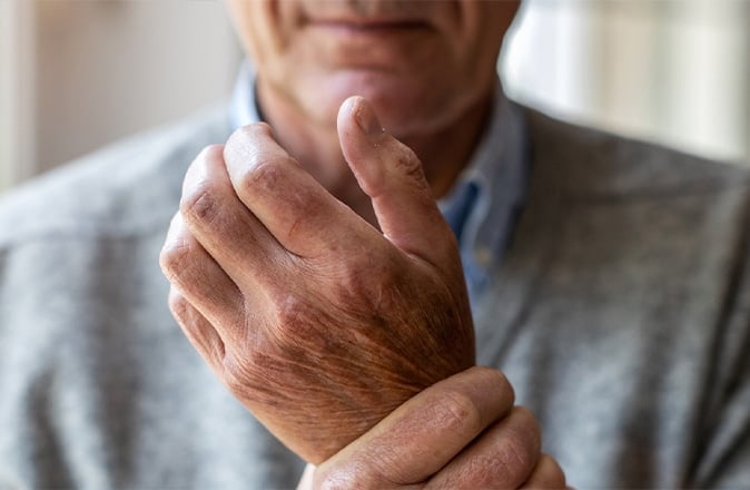 Een oudere man heeft last van reuma in zijn handen, een reumasoort.