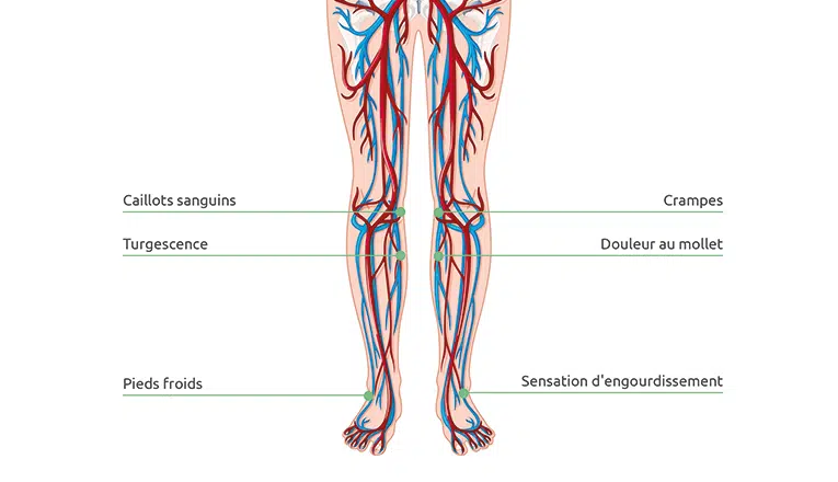 Représentation schématique de la circulation sanguine dans les jambes. Une mauvaise circulation provoque des jambes fatiguées.